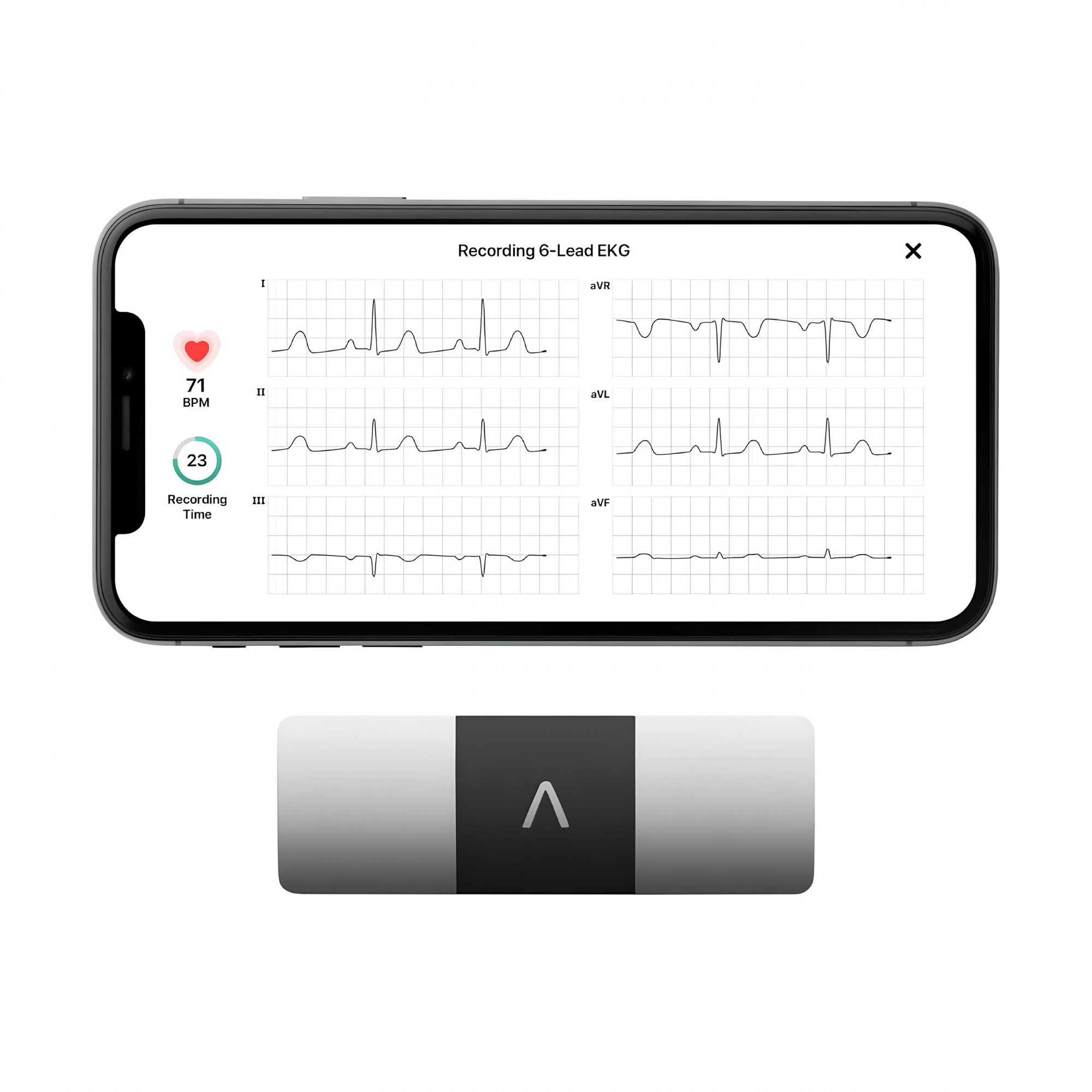 Персональный монитор ЭКГ AliveCor KardiaMobile 6-Lead Personal EKG Monitor